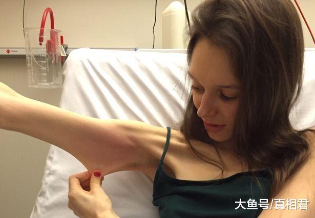 年轻的女厌食症患者体重只有25公斤! 正面临死亡危险!