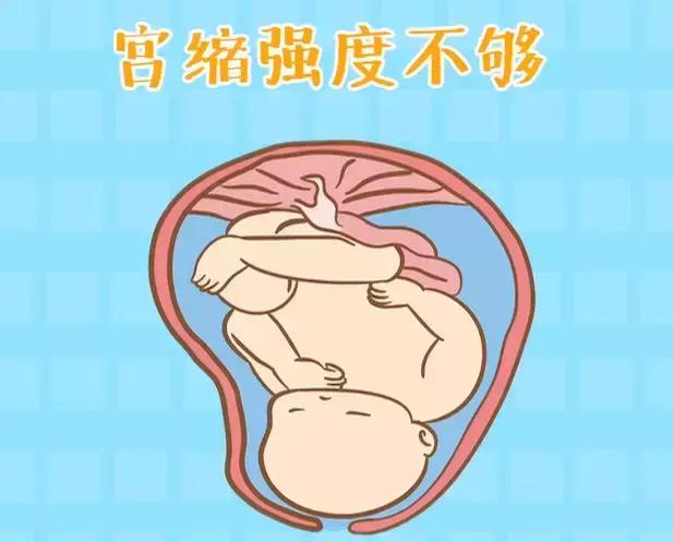 生孩子出现这2种情况，打催产素刻不容缓!