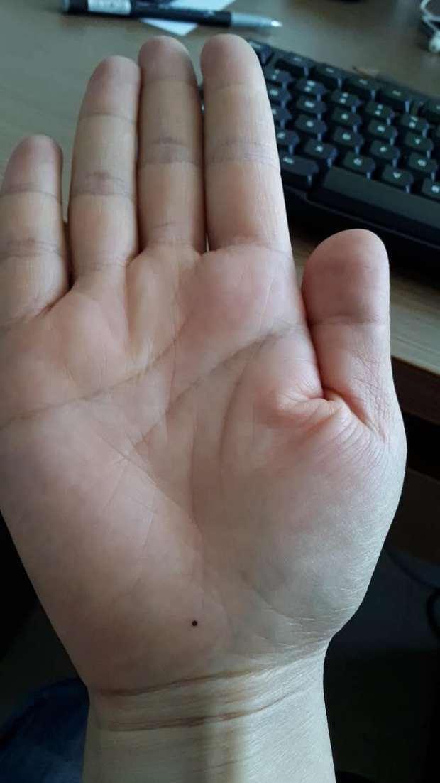 有黑痣是什么含义? 看手相黑痣算命图解!