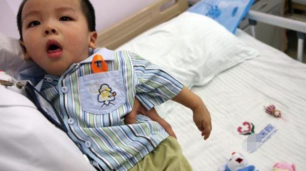 一岁半宝宝被查出脑白质髓鞘发育落后,家长们