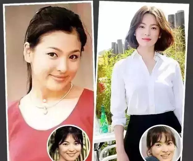 宋慧乔靠柠檬水减掉17公斤,水肿女也能变女神