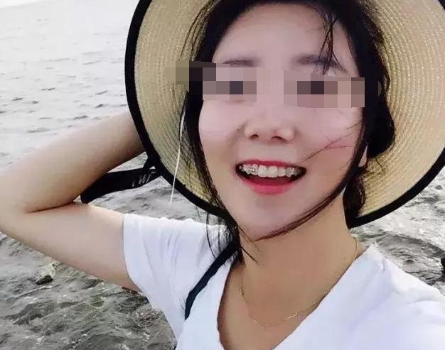 全家反对我做牙齿矫正,但我一刻也没有后悔过