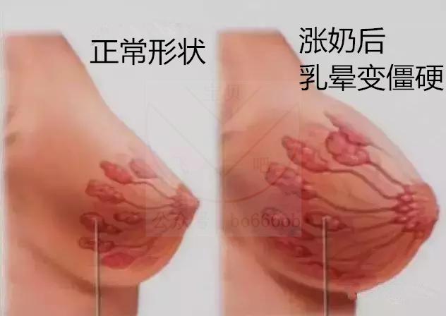 涨奶严重时也会引发"感冒",妈妈们可不要怕浪费