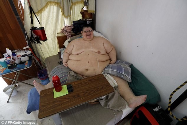 他被评为世界第一胖,减掉500斤后终于能站起来了