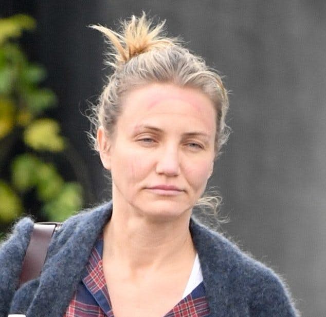 皮肤粗糙看起来像葡萄干20位好莱坞明星