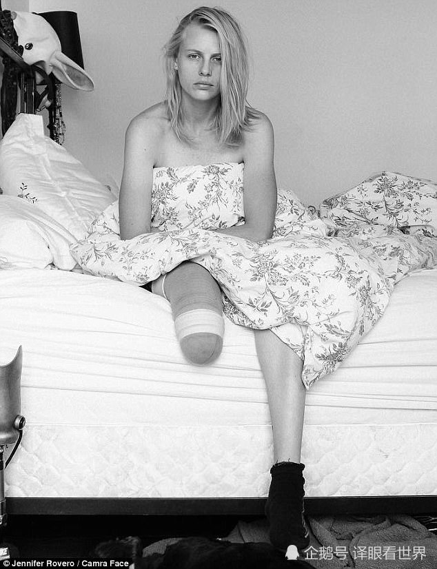 美国一模特使用卫生棉条导致中毒性休克,先后