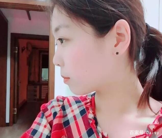 带牙套拍婚纱照吗_带牙套图片