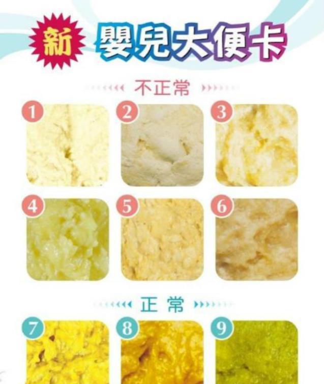 3: 吃配方奶或者混合喂养的宝宝大便:淡黄色或者黄棕色,大便看起来