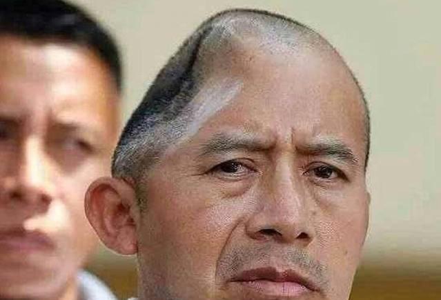 今天43岁的他,在劝架中不幸颅骨粉碎性骨折,居然没死还获得赔偿3.