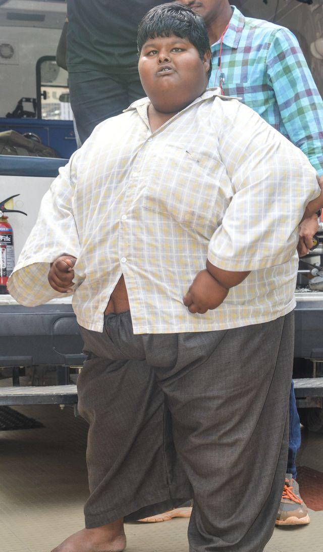 最胖的少年,印度15岁男孩体重300斤,3个月成功