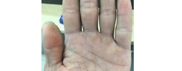 手相:只要生命线末端断裂、分叉,命苦之人,晚年