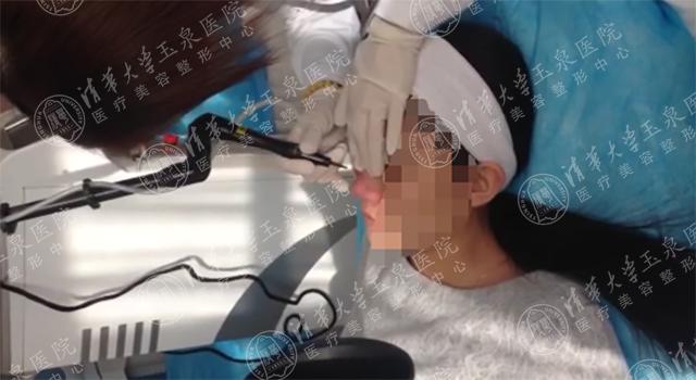 为啥一到换季时节脸就疯狂的长痘?