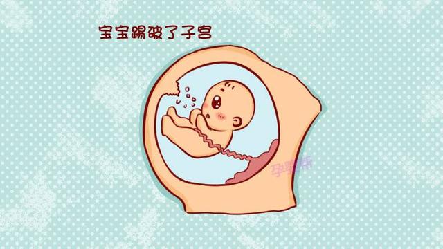 瘢痕子宫妈妈要宝宝前 这5件事一定要考虑周到