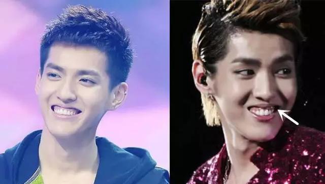 全球100张最美面孔榜单揭晓!可张开嘴你还敢叫全球最美?