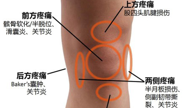 成语承什么膝_成语故事图片