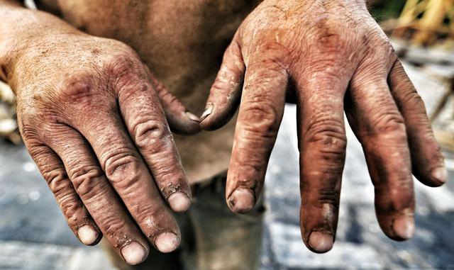 三农民工中秋坚守工地:每天钉2000钢钉,手掌吓人 !