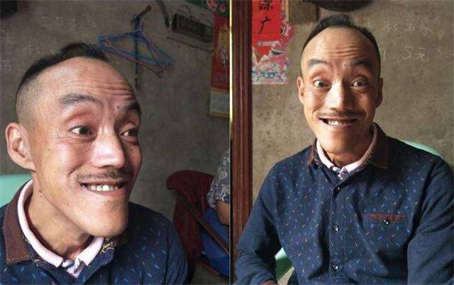 村里最丑最穷的男人，因长得像光头强，如今成为明星，年入100万