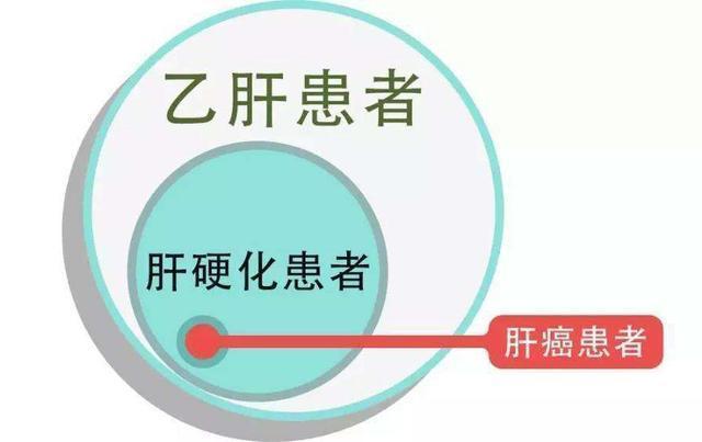 乙肝到肝癌到底有多远?