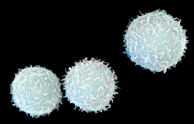 化疗后白细胞太低怎么办?告诉你,要注意饮食原