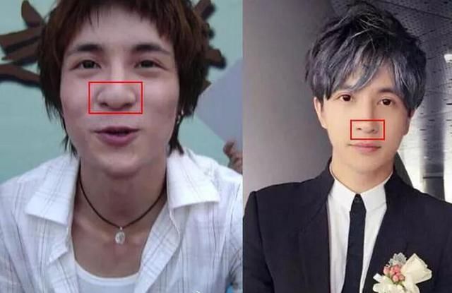 娱乐圈整容脸跟天然脸站一起，网友：一对比太明显！