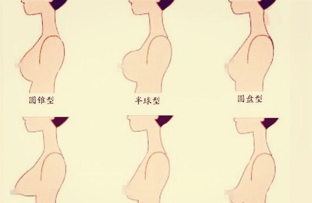 胸型图片_纵览新闻