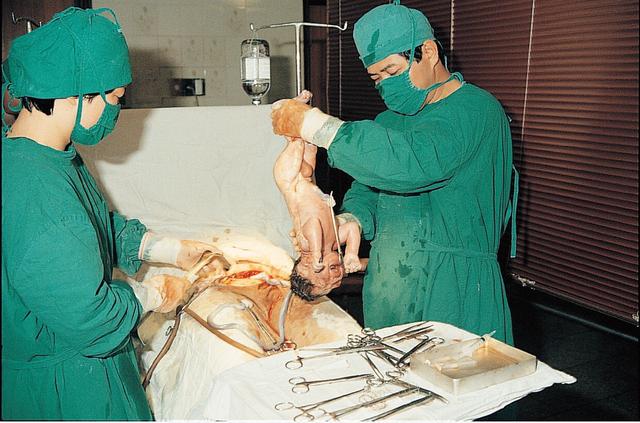 图解女人剖腹产手术全过程，胆小者勿入