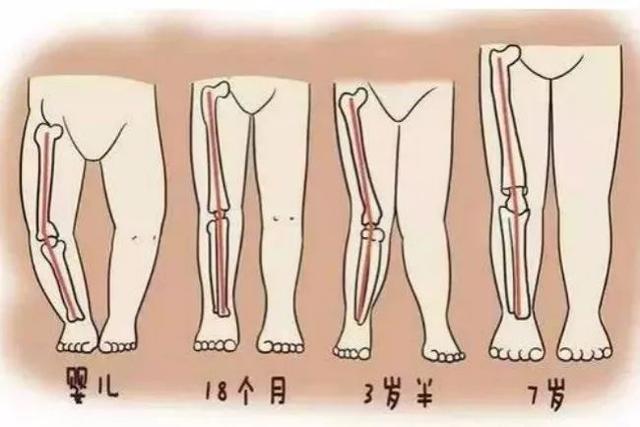 宝宝肋外翻,o型腿,x型腿是缺钙吗?