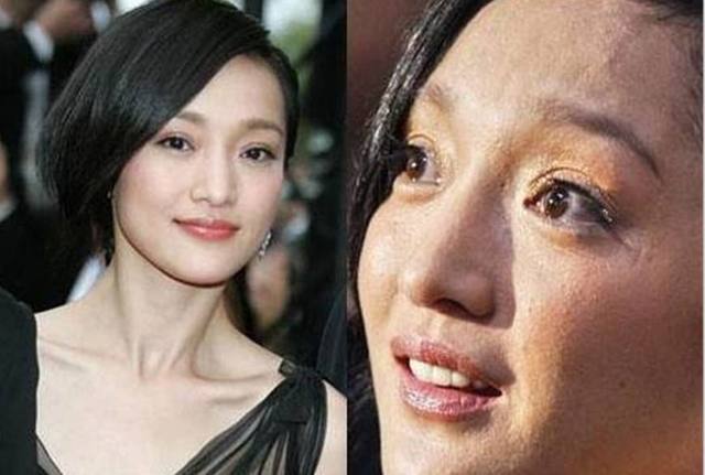 同是皮肤不好，刘诗诗孙燕姿已经够吓人了，却输给了她