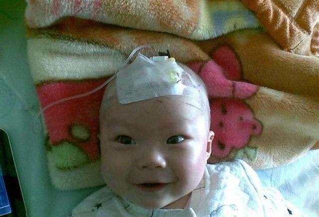 3个月宝宝口吐白沫,妈妈以为是吐奶没当回事,