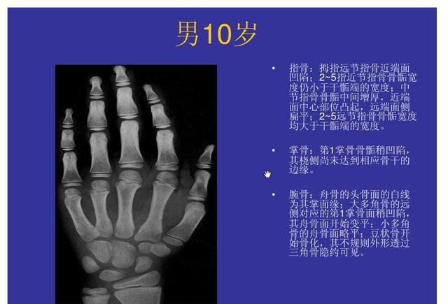 想知道孩子能长多高吗骨科干货儿童骨龄检测对照表