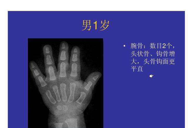 想知道孩子能长多高吗骨科干货儿童骨龄检测对照表