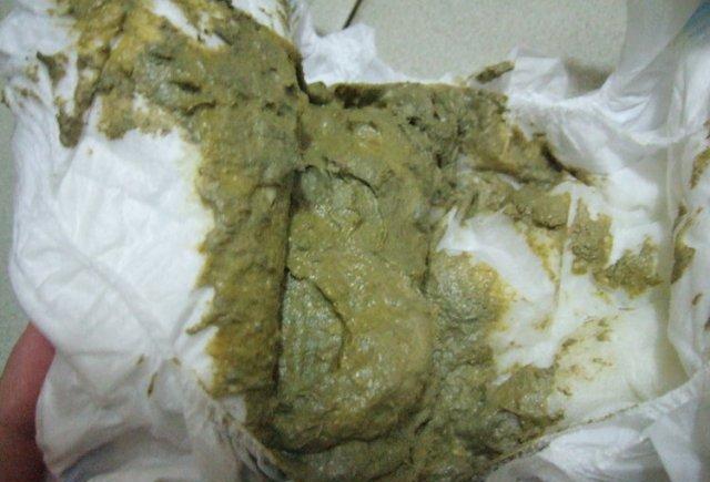 宝宝的屎事真多,一篇文章教你搞懂宝宝的大便