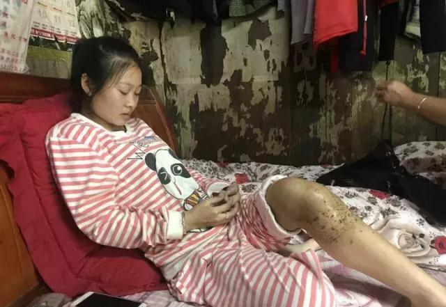 镇远年轻女孩因病遭婆家抛弃 医治无效死亡 志愿者为