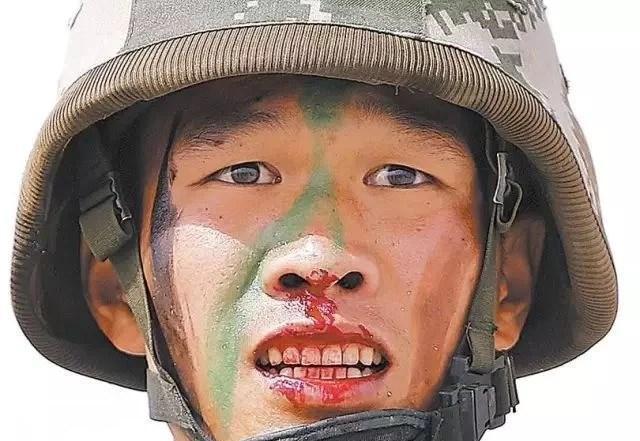 一个解放军战士受伤流血,依然面带微笑.