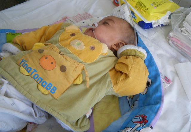 感冒和脑膜炎如何区分?别再傻傻耽误孩子的病