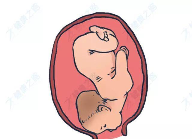 孕检发现胎位不正怎么办?其实并没有那么可怕!|胎儿