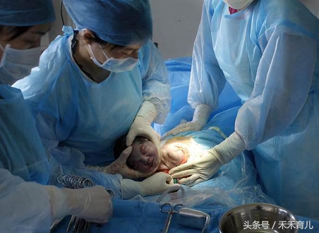 十个产妇九个侧切,幸运!我就是那一个没侧切的!