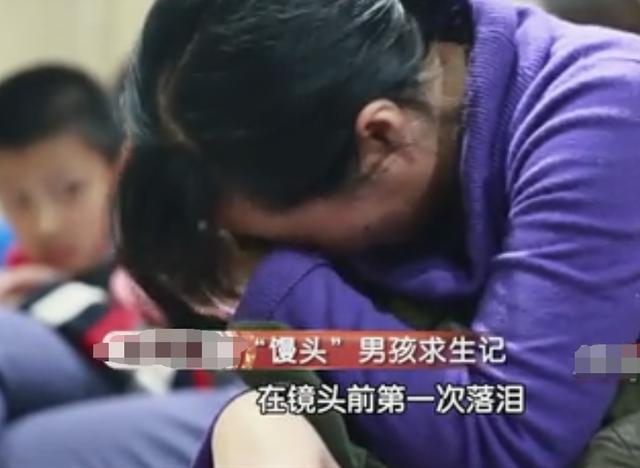 1岁孩子肚子异常肿大经检查原来是得了乳糜腹