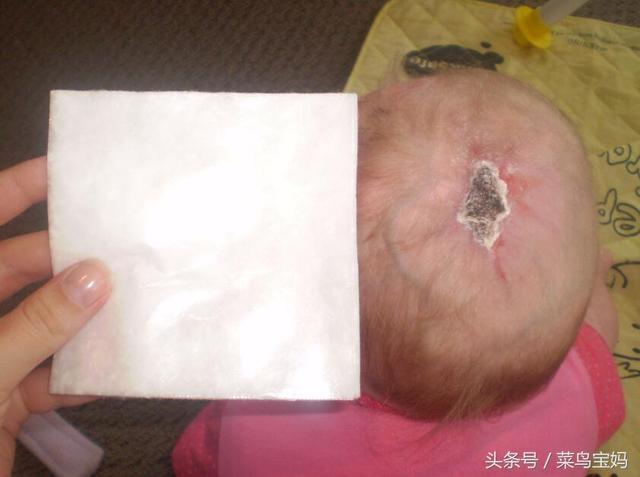 卤门是什么?新生儿宝宝的卤门需要重点保护!