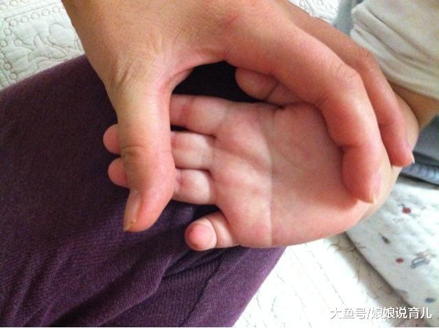 断掌纹和唐氏综合症有直接关系吗? 原来这才是最正确