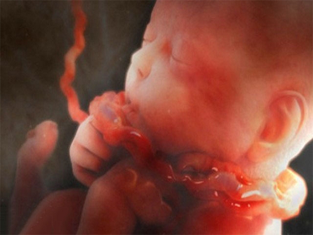 怀孕36周胎死腹中,孕妇说道只是为了顺产是少受罪,医生气红了脸
