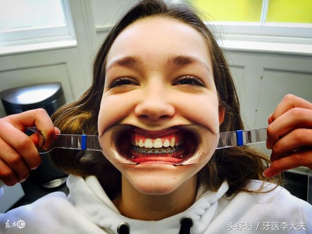 7岁女孩牙齿烂光只剩牙根,医生说只能这么做…