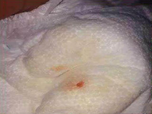 1岁半孩子不说话别不当回事,监控回放画面全家