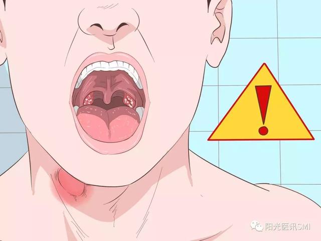 怎么分辨嗓子疼是什么原因引起的?