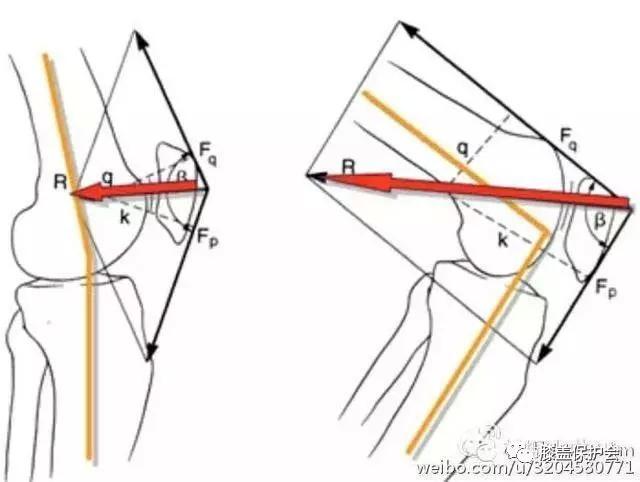 静蹲不是治愈膝盖问疼的万能药!