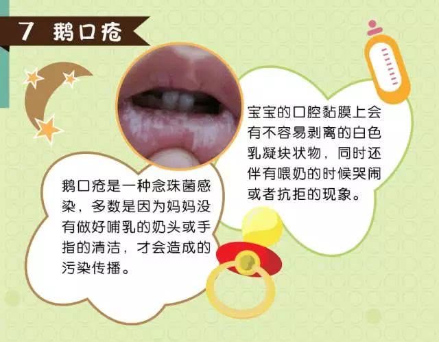 防止鹅口疮感染最有效的办法就是要注意清洁.