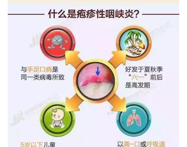 儿子反复高烧至40度,该不该住院输水?疱疹性咽