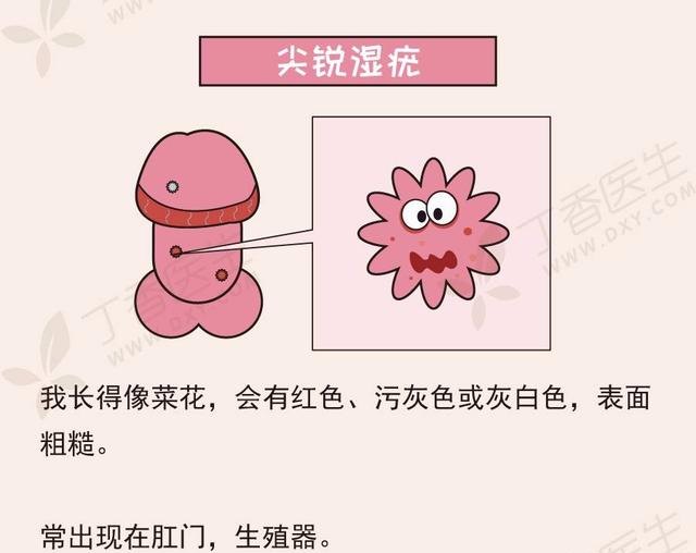 尖锐湿疣不难治,10点预防 2个食疗,清毒消疣,7天一步