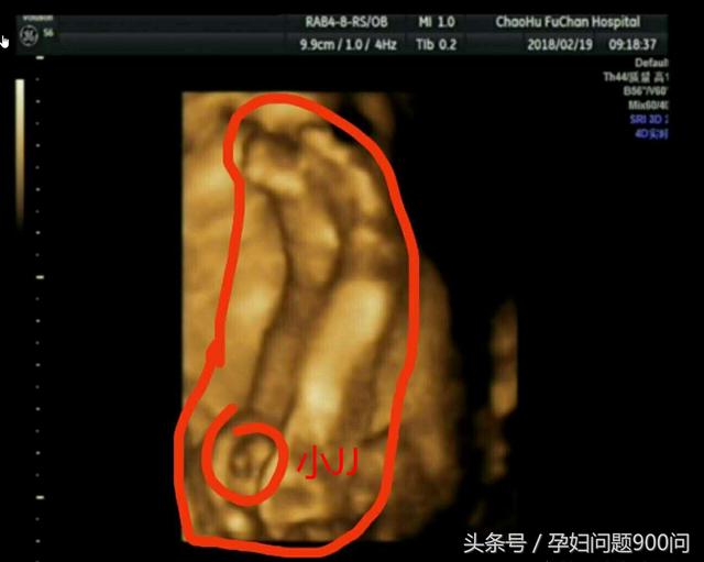 四维彩超回来我笑了,居然看到了儿子的小jj