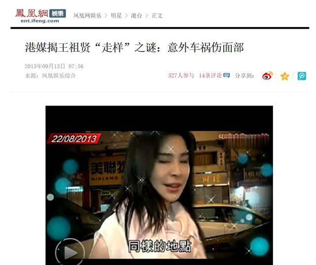 王祖贤出过一次车祸，可以查查，要不不会变化那么多？
